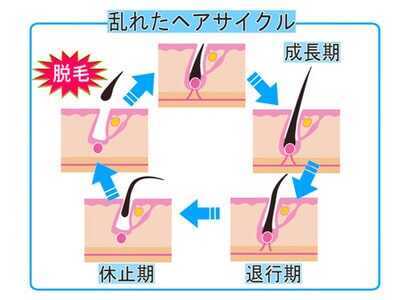 ヘアサイクルを正常にして抜け毛を少なく