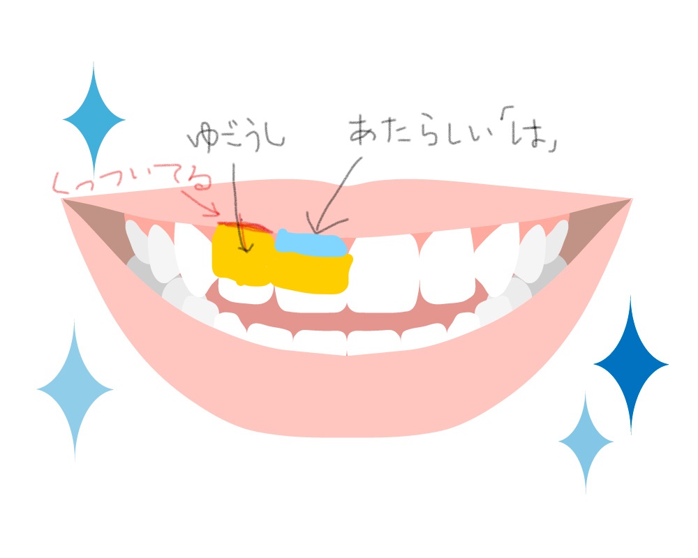 f:id:chaarchan:20211015153036j:plain