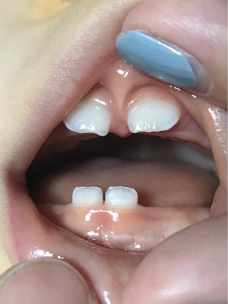 f:id:chakipoyo:20180707114023j:image