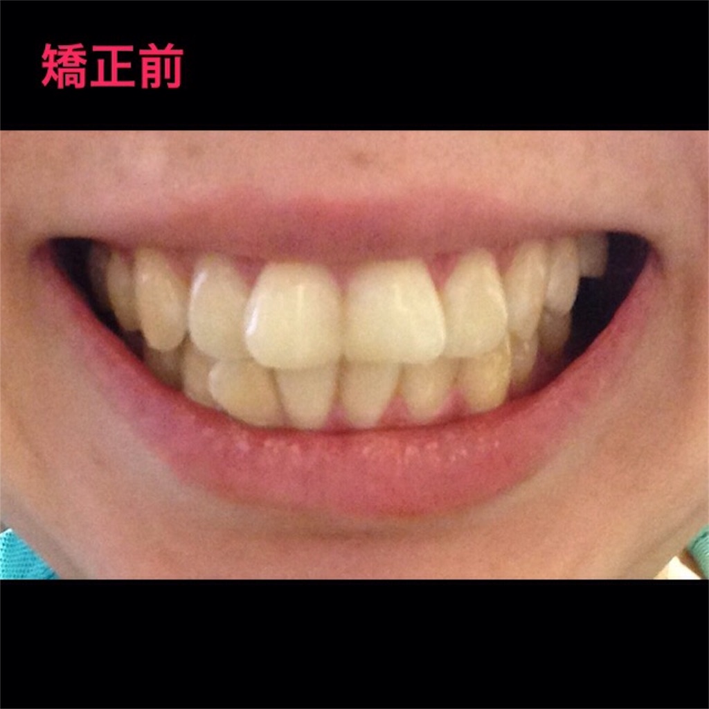 f:id:chamichobi:20161216140431j:image