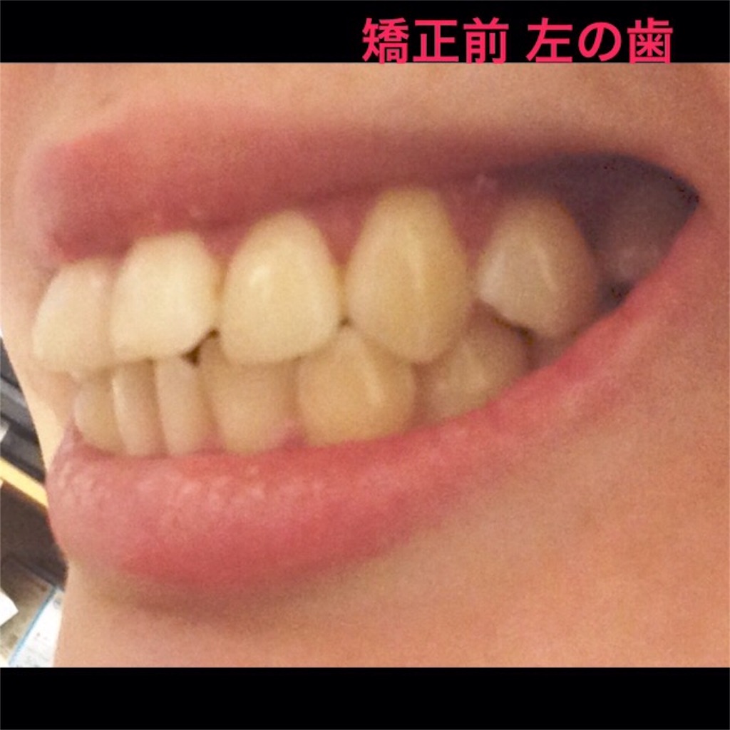 f:id:chamichobi:20161216140649j:image