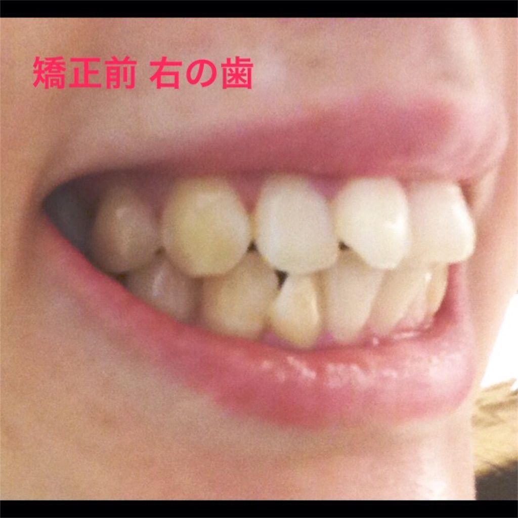 f:id:chamichobi:20170115165613j:image