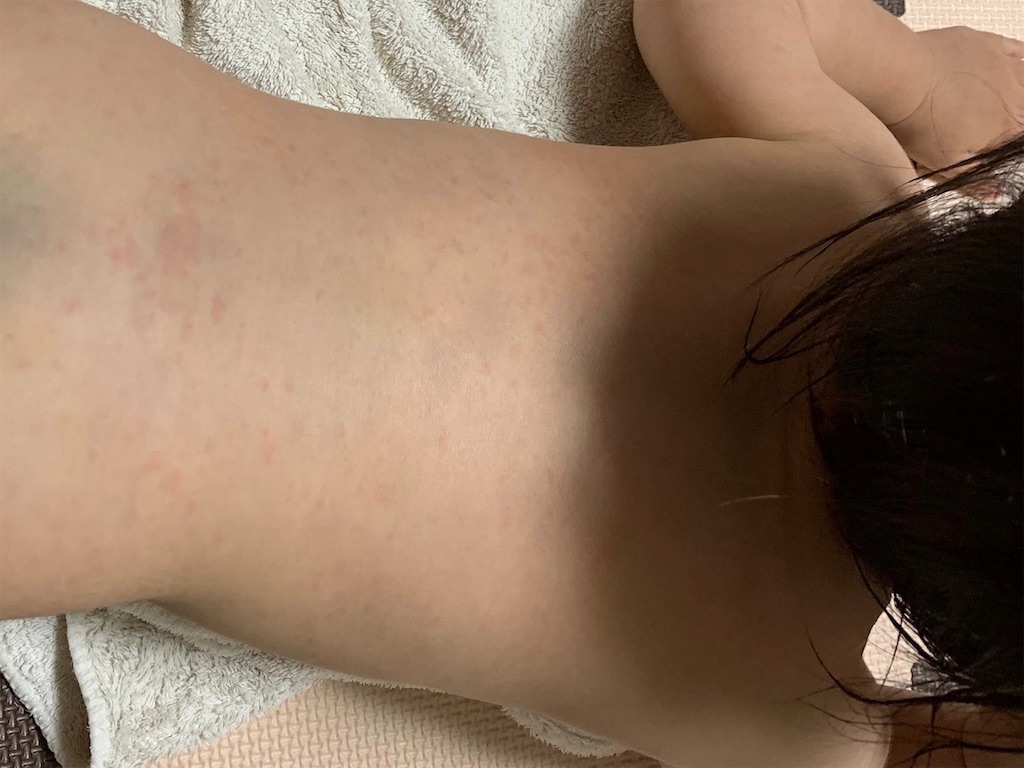 f:id:chan-mama:20190718202304j:image