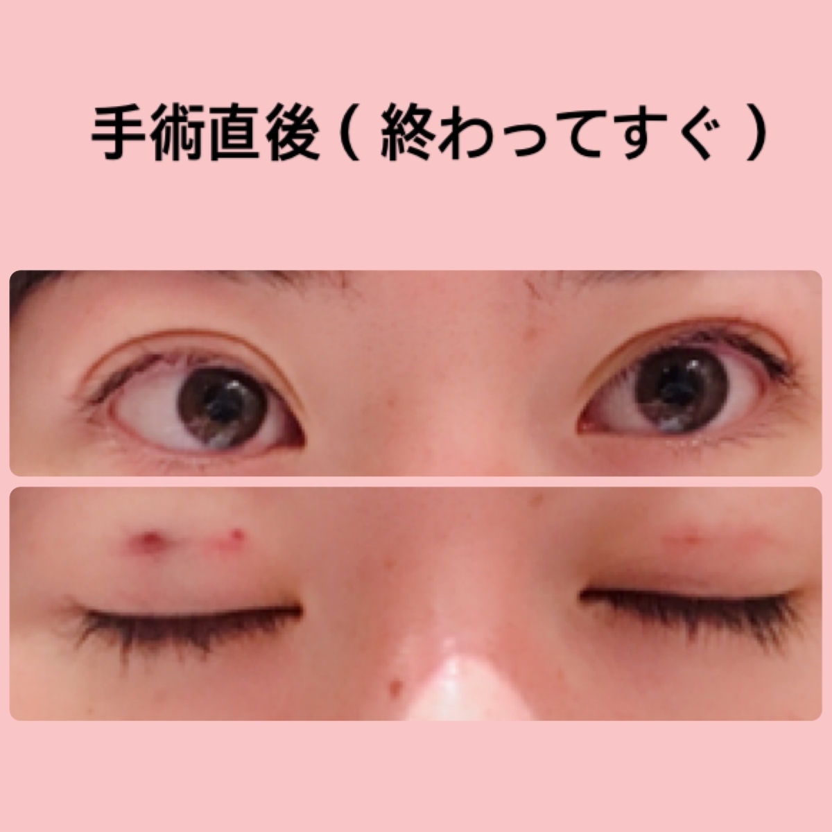 f:id:chanaoi214:20190502023000j:plain f:id:chanaoi214:20190502023000j:plain