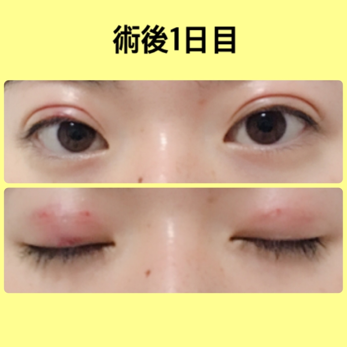 f:id:chanaoi214:20190502024451j:plain f:id:chanaoi214:20190502024451j:plain