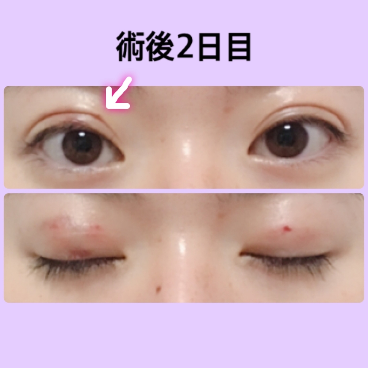 f:id:chanaoi214:20190505013213j:plain f:id:chanaoi214:20190505013213j:plain