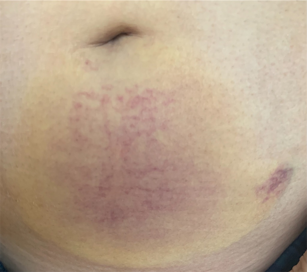 f:id:chanmiso:20240810225312j:image