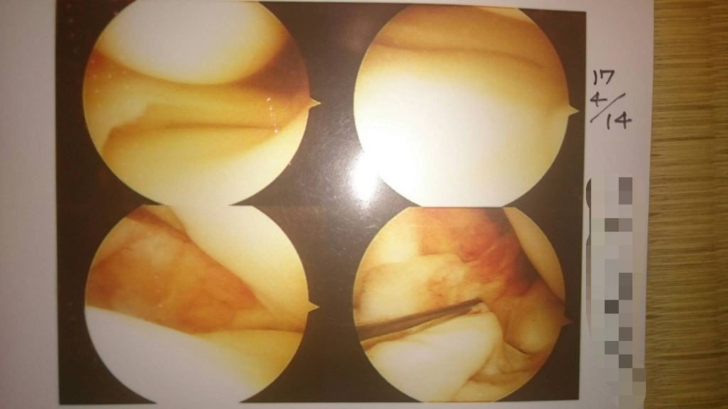 f:id:chanryo8126:20170429211620j:plain