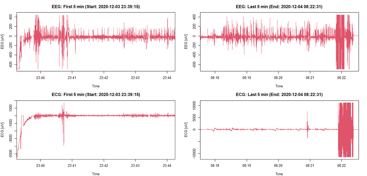 eeg 2011年 Rで生体信号解析1】EDFファイルの読み込み - ケィオスの時系列解析
