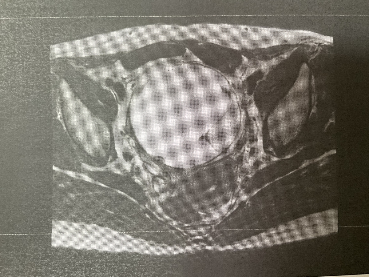 f:id:cheese319:20210913163342j:plain