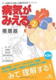 病気がみえる vol.2 循環器―Medical Disease:An Illustrated Reference