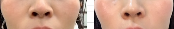 f:id:chidoriashi27:20211111173744p:plain