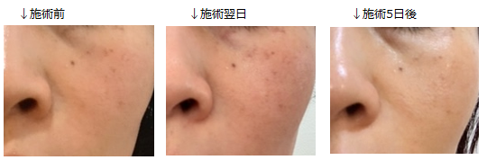 f:id:chidoriashi27:20220109180044p:plain