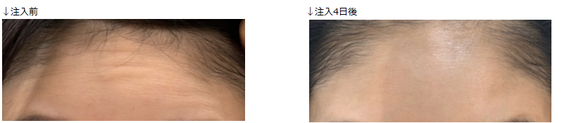 f:id:chidoriashi27:20220310183209p:plain
