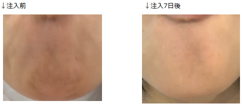 f:id:chidoriashi27:20220310183238p:plain