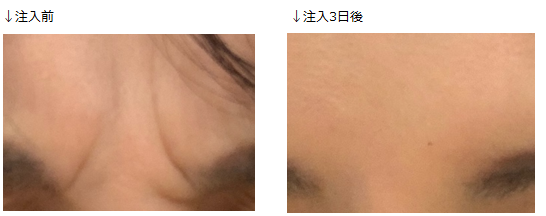 f:id:chidoriashi27:20220310183319p:plain