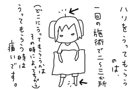 ハリをさしてもらっているイラスト