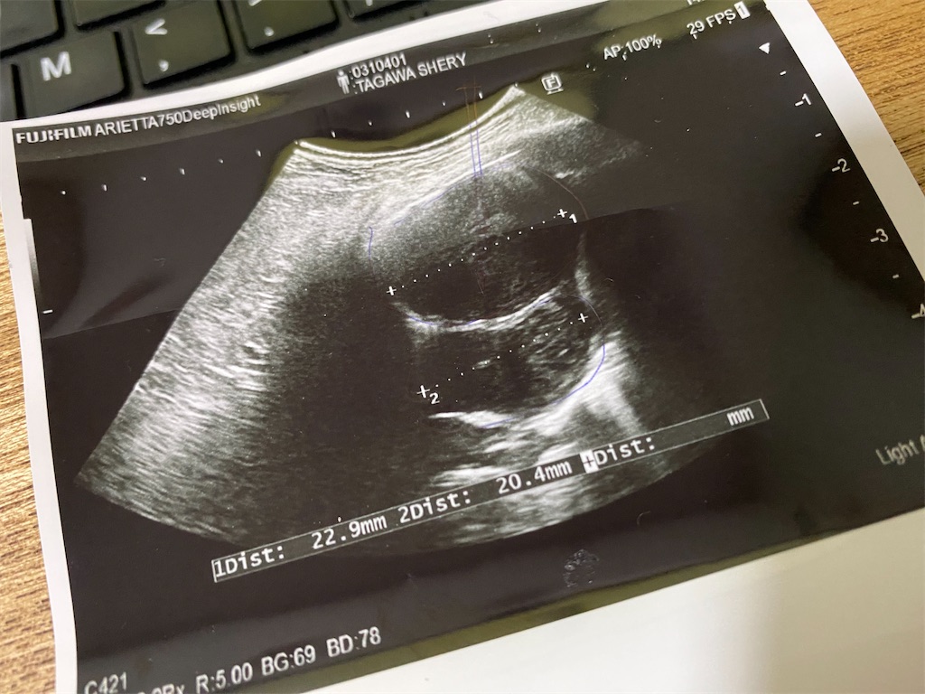 f:id:chihiroukiuki:20231226232238j:image