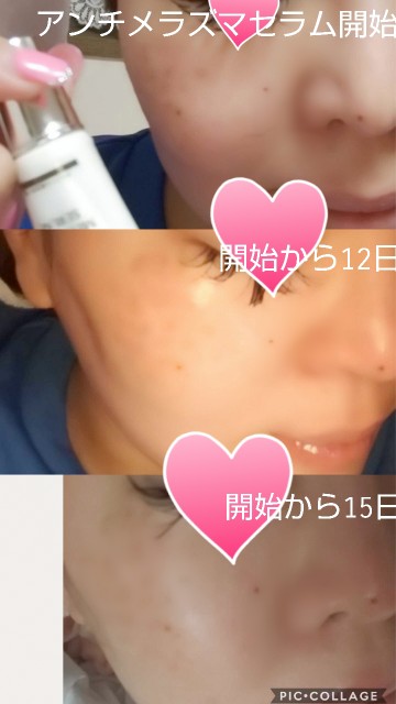 f:id:chiichii555:20181108033457j:image