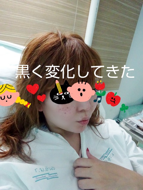 f:id:chiichii555:20181223051345j:image