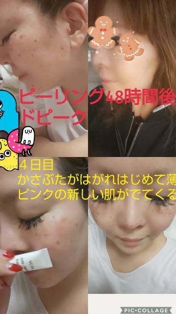 f:id:chiichii555:20181223051534j:image