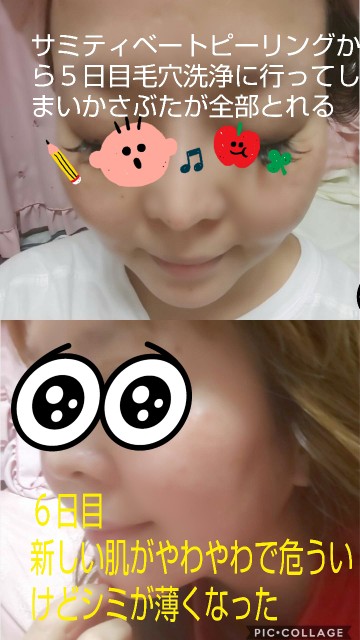 f:id:chiichii555:20181223051554j:image