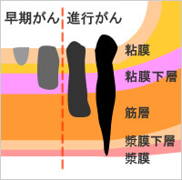 f:id:chikojirou:20161210205550j:plain