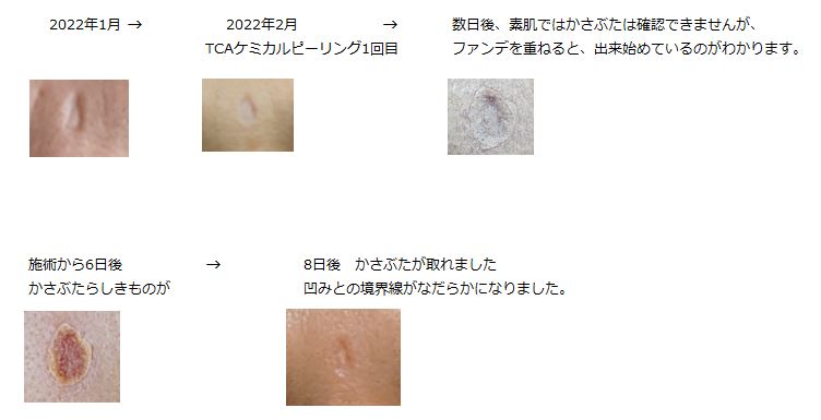 f:id:chikujp:20220404174328j:plain