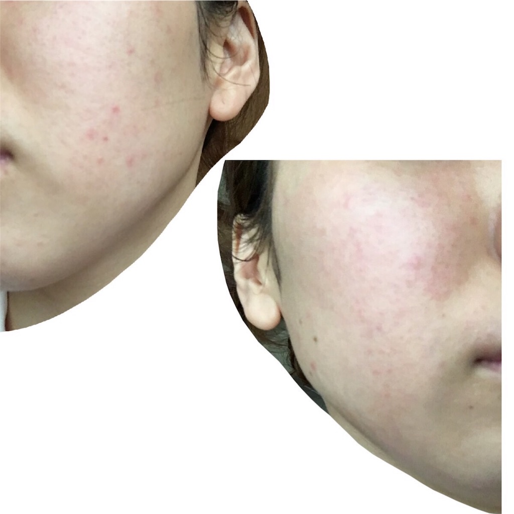 f:id:chillbelle:20170510111610j:image f:id:chillbelle:20170510111610j:image