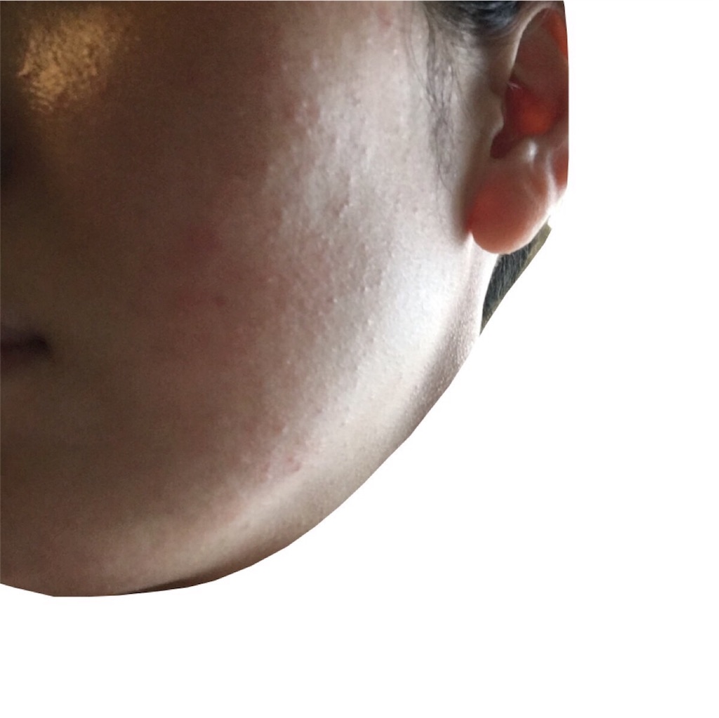 f:id:chillbelle:20170605093210j:image f:id:chillbelle:20170605093210j:image