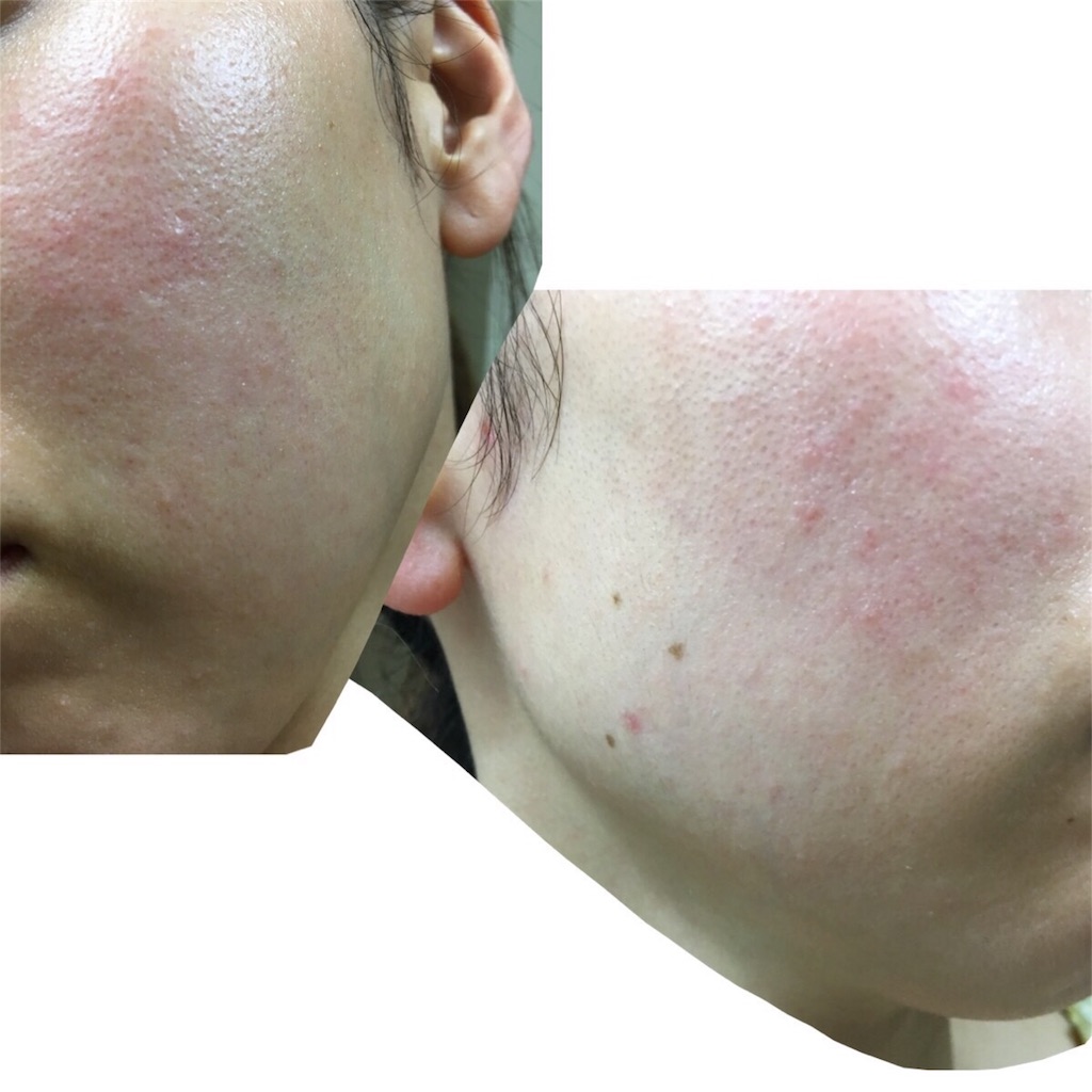 f:id:chillbelle:20180921000728j:image