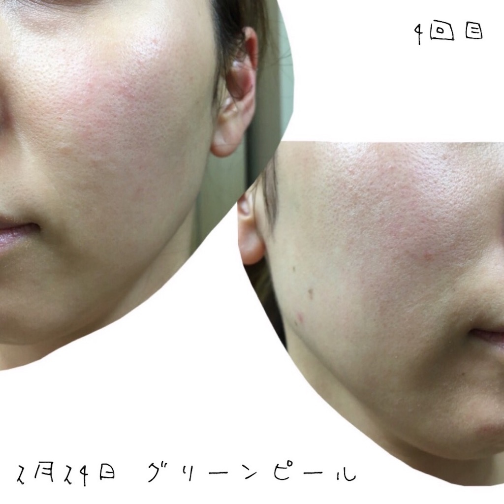 f:id:chillbelle:20190906120931j:image f:id:chillbelle:20190906120931j:image