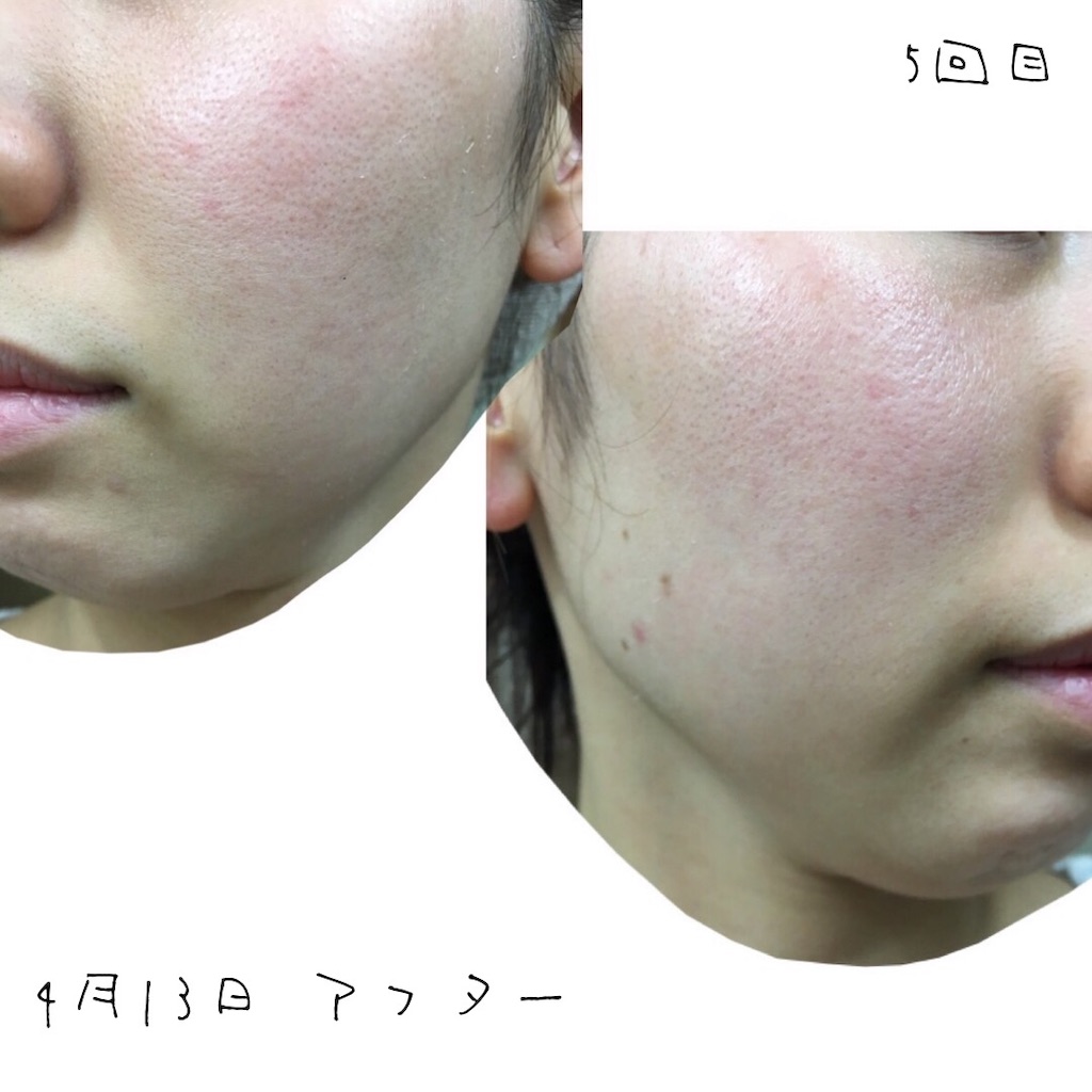 f:id:chillbelle:20190906122339j:image f:id:chillbelle:20190906122339j:image