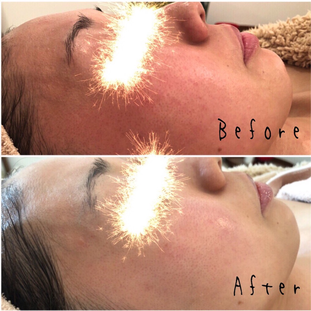 f:id:chillbelle:20190906125903j:image f:id:chillbelle:20190906125903j:image