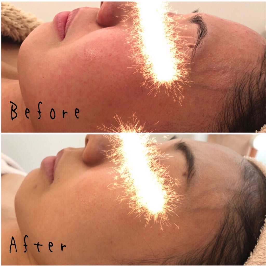 f:id:chillbelle:20190906125908j:image f:id:chillbelle:20190906125908j:image