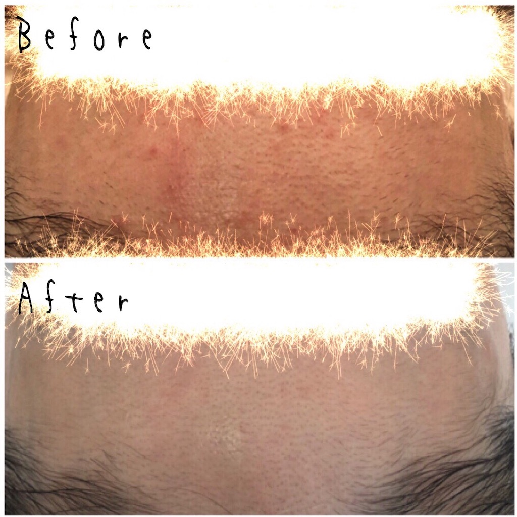 f:id:chillbelle:20190906125915j:image f:id:chillbelle:20190906125915j:image