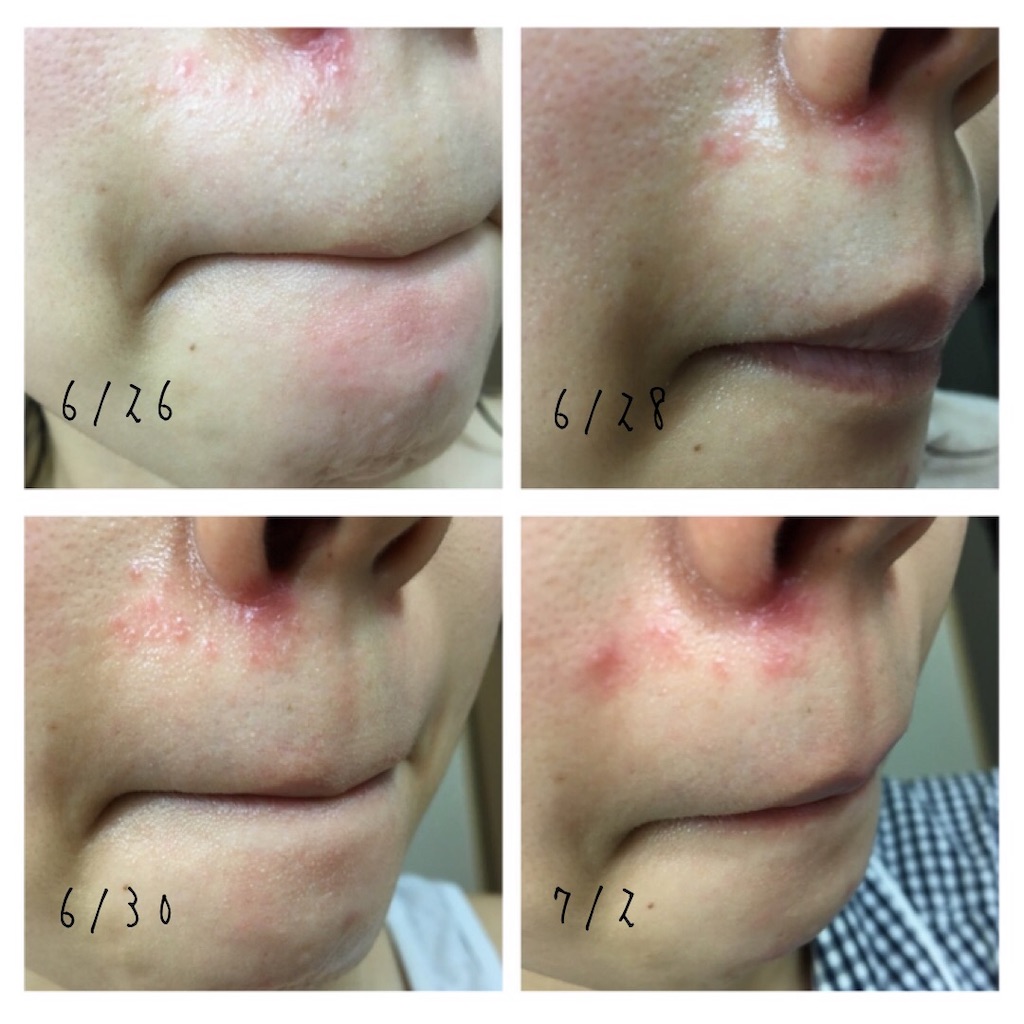 f:id:chillbelle:20190906141457j:image f:id:chillbelle:20190906141457j:image