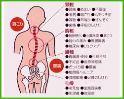 f:id:chiro-clover:20170608112323j:plain