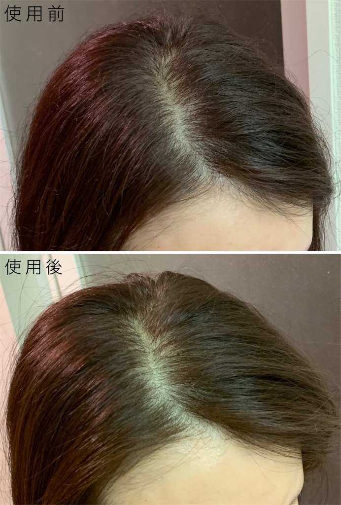 f:id:chiro821012:20210512151702j:image f:id:chiro821012:20210512151702j:image