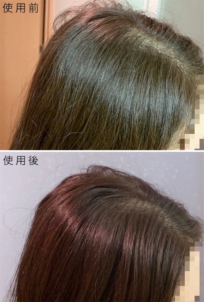 f:id:chiro821012:20210512151713j:image f:id:chiro821012:20210512151713j:image
