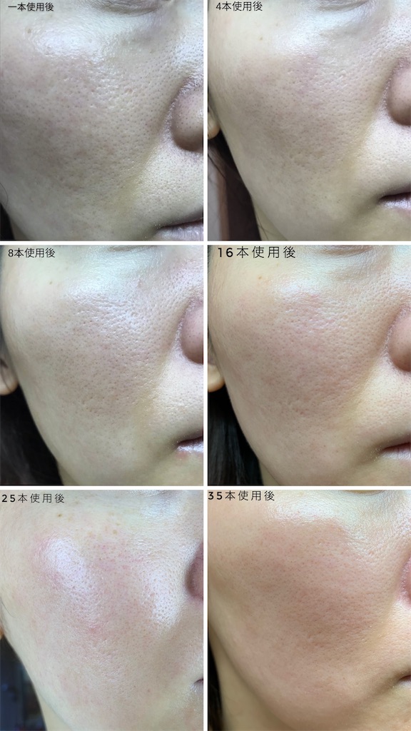 f:id:chiro821012:20220111162852j:plain