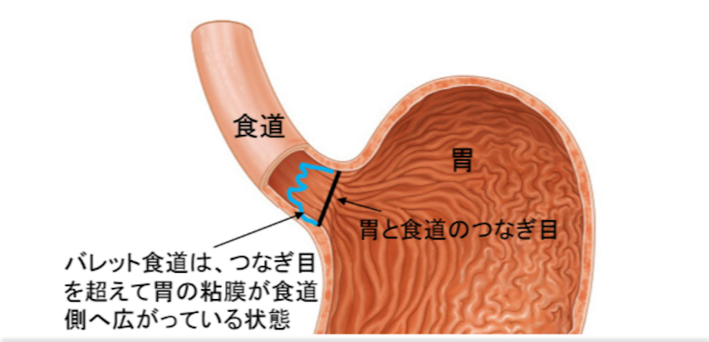f:id:chisa_love:20190211103609p:image f:id:chisa_love:20190211103609p:image