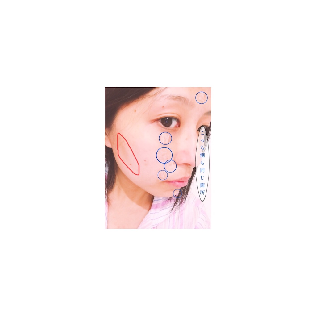 f:id:chokichokihair:20200426210829j:image f:id:chokichokihair:20200426210829j:image
