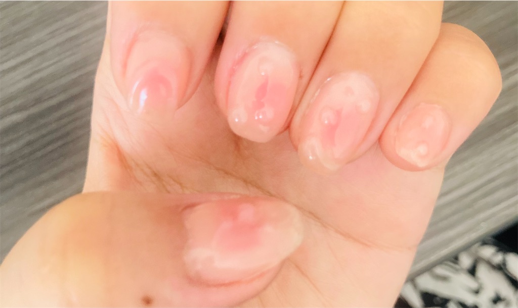 f:id:chokin120:20250628163317j:image