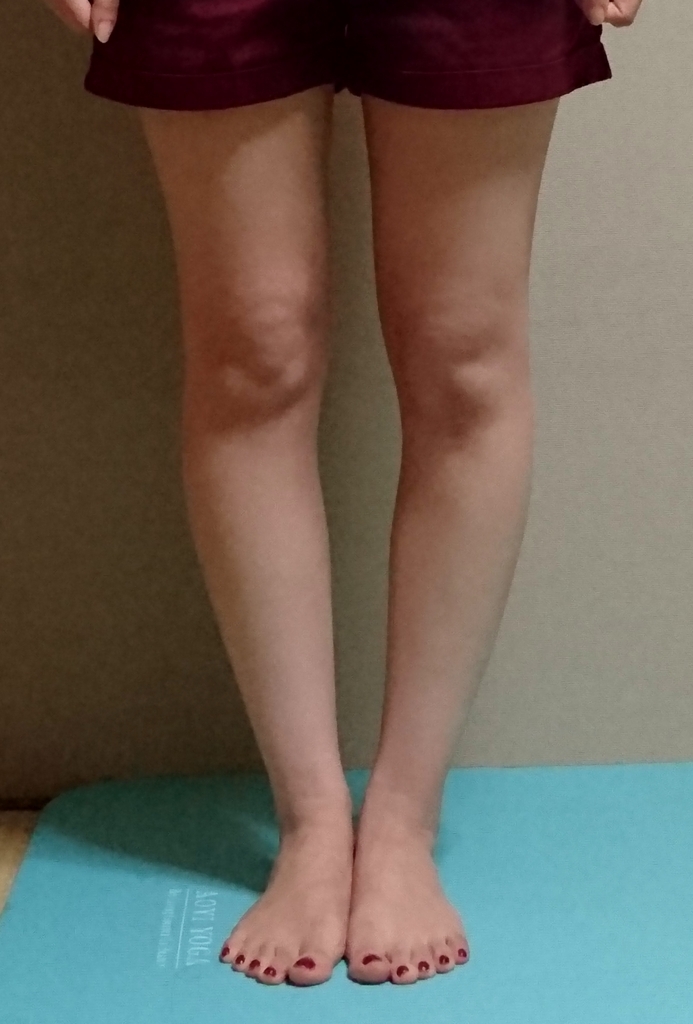 O脚矯正プログラム「福辻式」 o脚矯正プログラム 「福辻式」