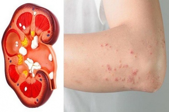 f:id:chuabenhthaninfo:20190809164623j:plain f:id:chuabenhthaninfo:20190809164623j:plain