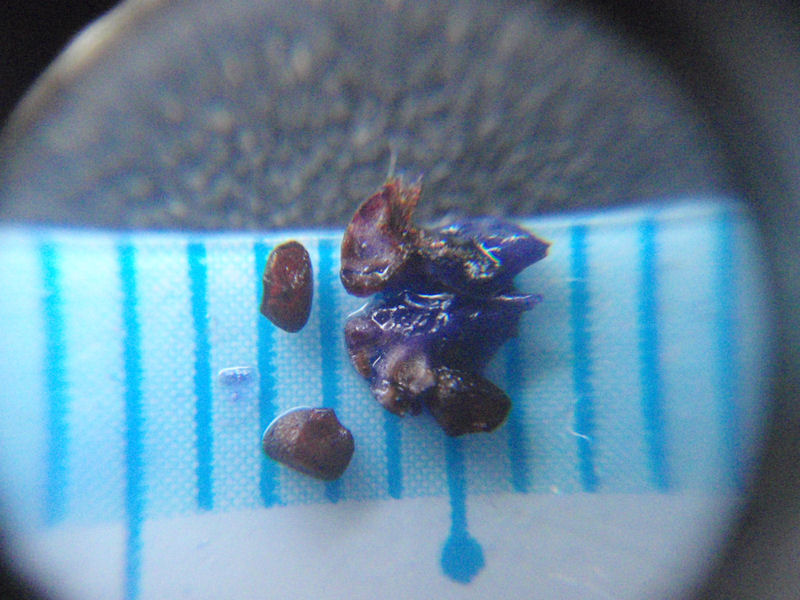 f:id:chuumeikun:20171221195258j:plain