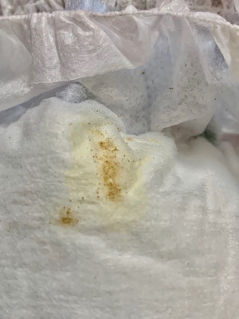 ペット(犬)　ライくんの話８　ご飯(食事療法)＆尿結石！？（蛋白漏出性腸症・低タンパク血症・低アルブミン血症)