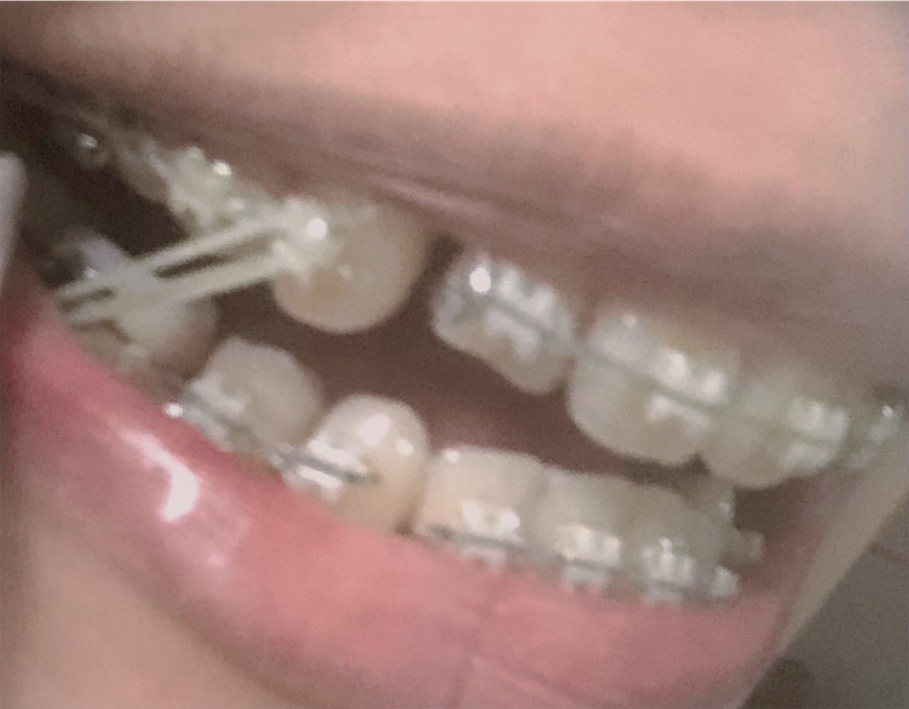 f:id:cinnamonbrown:20220305124037j:image