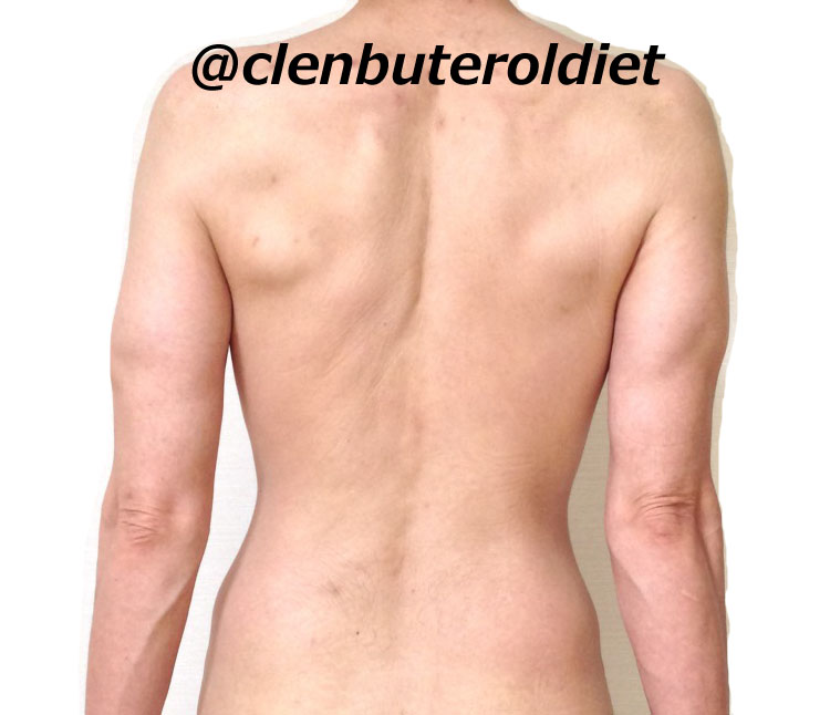 f:id:clenbuteroldiet:20170725160354j:plain